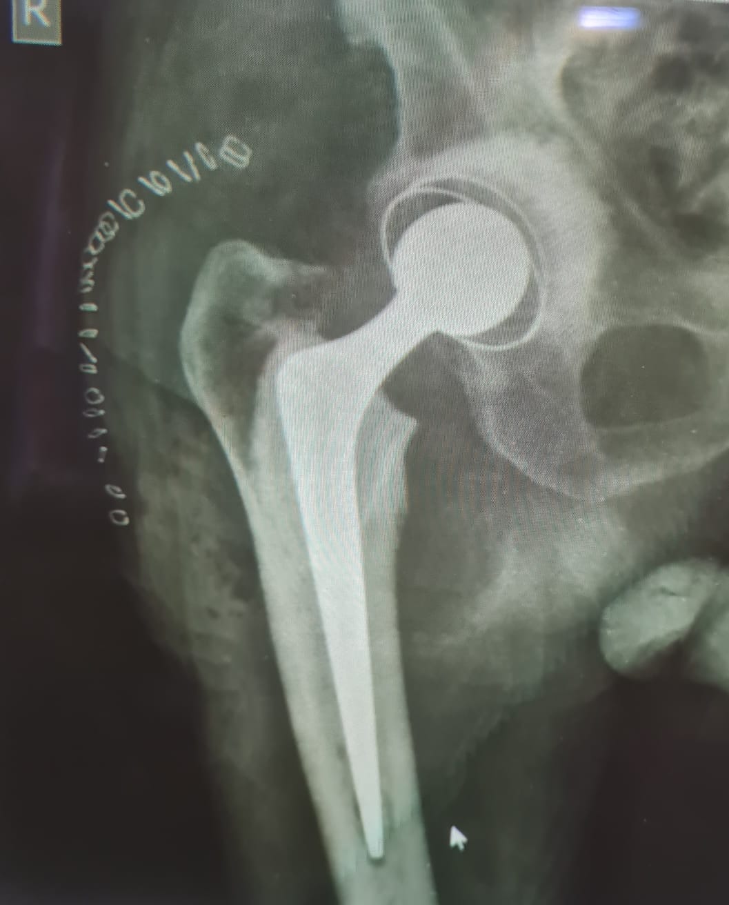 X-Ray image 5
